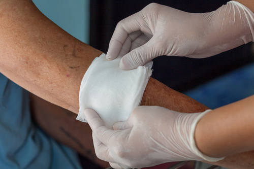 An image of a bandage being applied to someone's arm. 